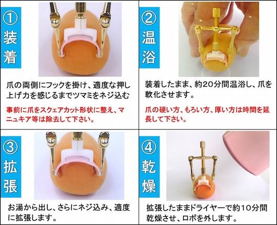 makizume-robo-ingrown-toenail-fixer-straightener-2