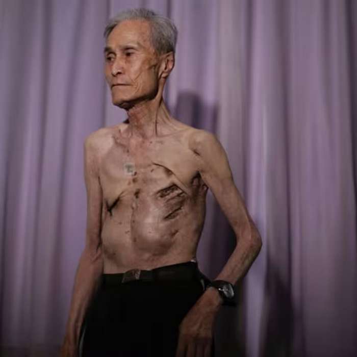 Tsutomu Yamaguchi, sobrevivente de duas bombas atômicas
