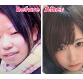 A transformação dessa mulher japonesa de 25 anos através da cirurgia plástica choca a Internet