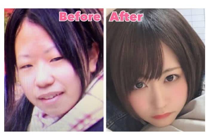 A transformação dessa mulher japonesa de 25 anos através da cirurgia plástica choca a Internet